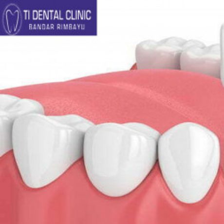 Group logo of Braces: When Kids Need Orthodontic