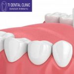 Group logo of Braces: When Kids Need Orthodontic